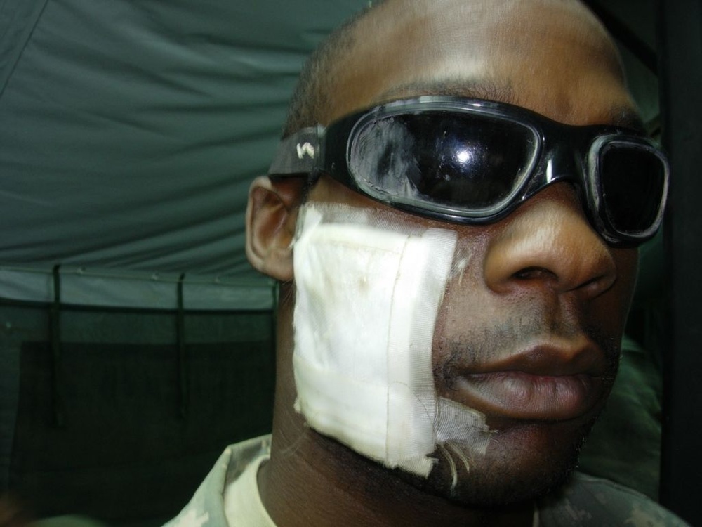 Eye Protection Saves Infantryman's Vision