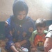 Young girl fitted for prosthetic