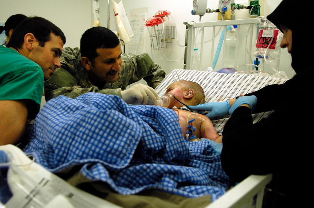 Little, but strong: burned Iraqi child overcomes odds