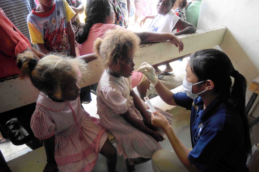 Fluoride Treatments For Children