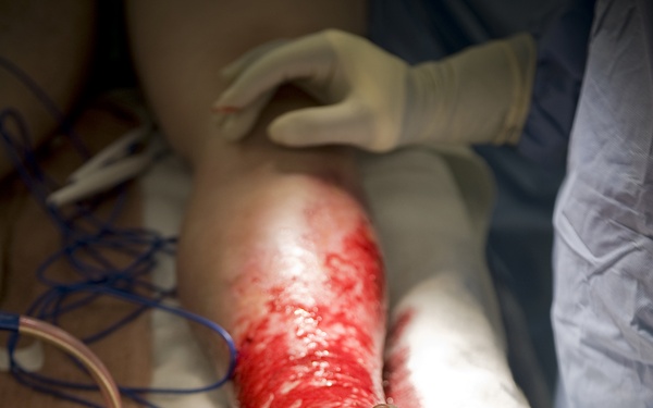 Brook Army medical center