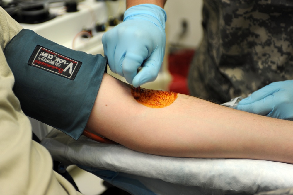 Blood Platelet Donations Vital in Deployed Environment