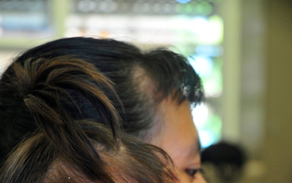 Japanese Self Defense Force medical staff support Pacific Partnership 2011