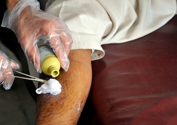 Free clinic treats wounds and educates locals