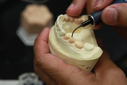 Dental techs bare teeth in Miramar