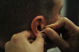 Inserting the needle