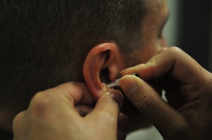 Acupuncture