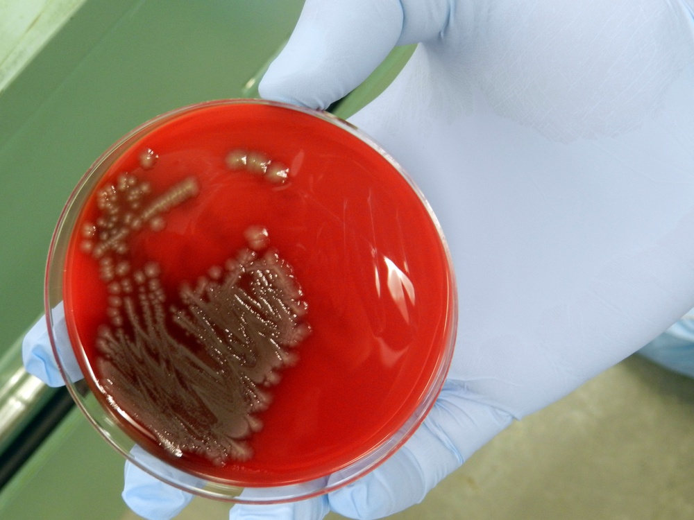E.coli culture helps soldiers train
