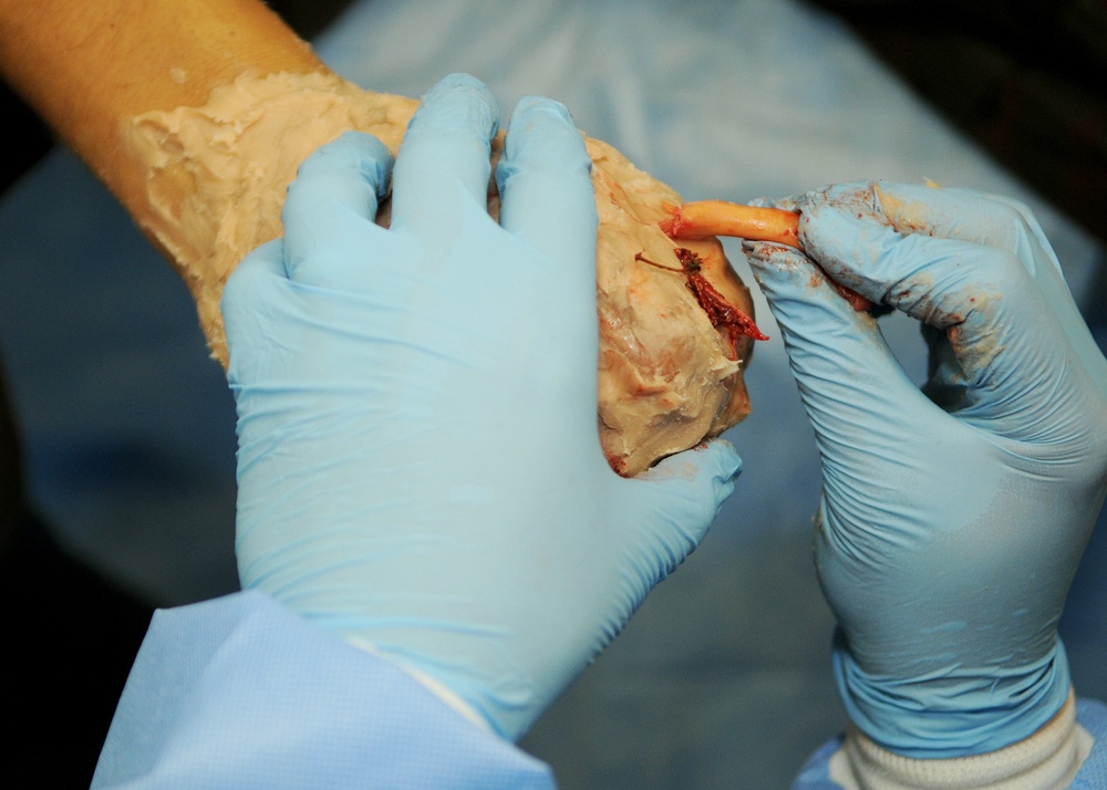 Exercise melds Bosnian-Herzegovinian military, civilian medical communities