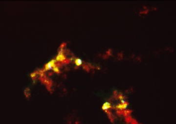 HST Reveals Stunning Detail in Herbig-Haro Object