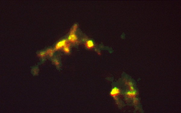 HST Reveals Growth Processes of Young Star