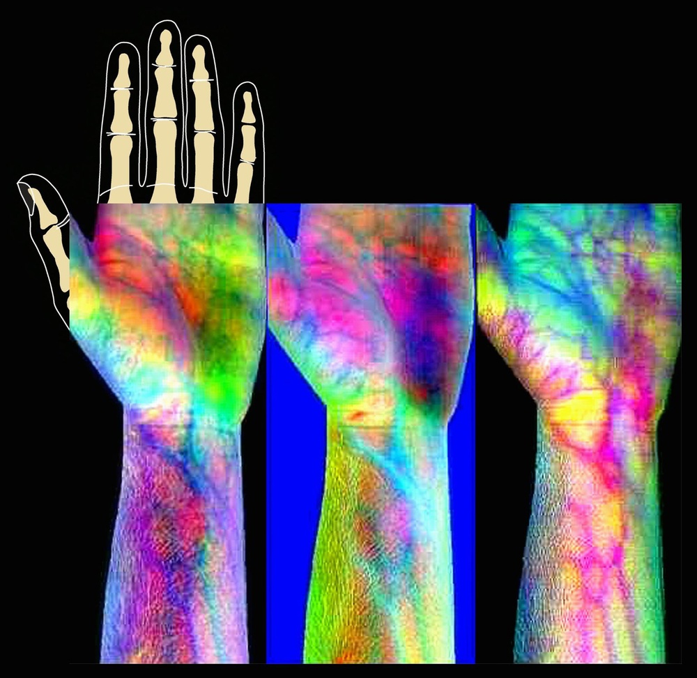 Hyperspectral Imaging of human arm