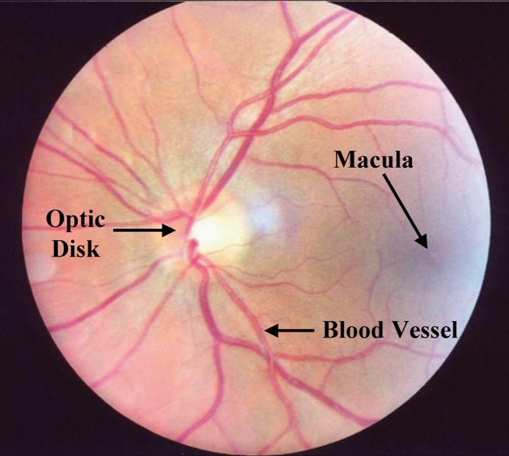Scan of the back of human eye