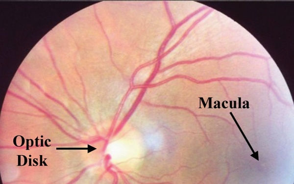 Scan of the back of human eye