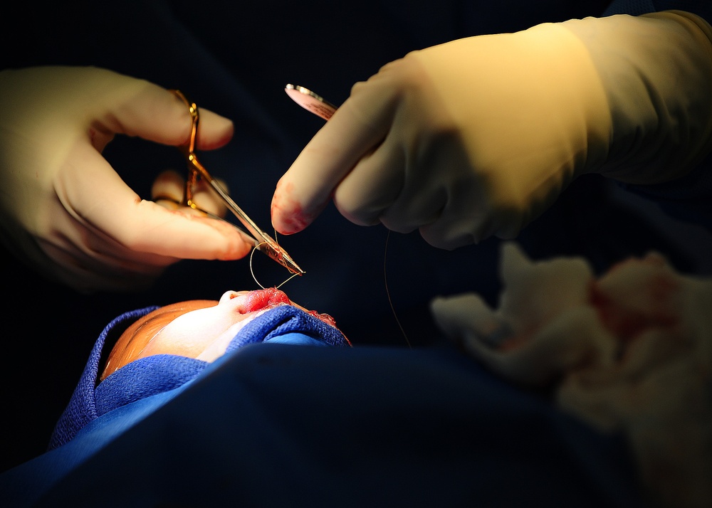 New Horizons surgical team changes lives in Belize