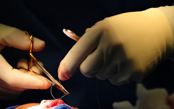 New Horizons surgical team changes lives in Belize