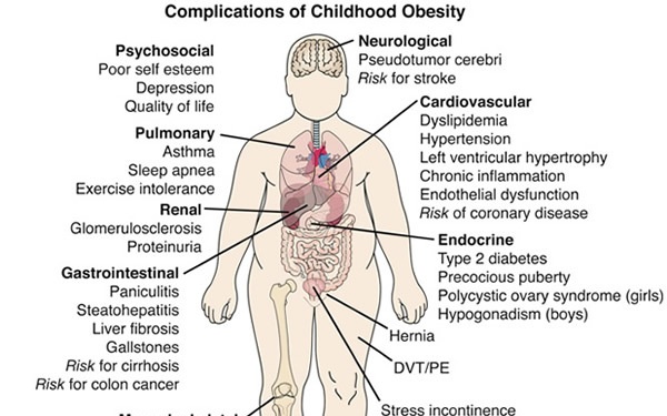 Exercise deficit disorder in youth