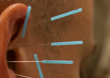 On pins and needles: Navy doctor branches out with deployment medicine