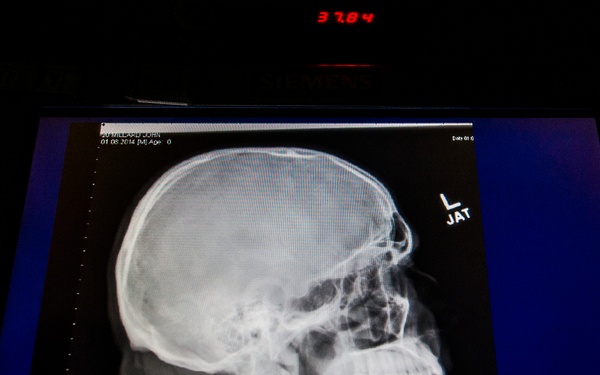 TCM commander learns X-ray techniques