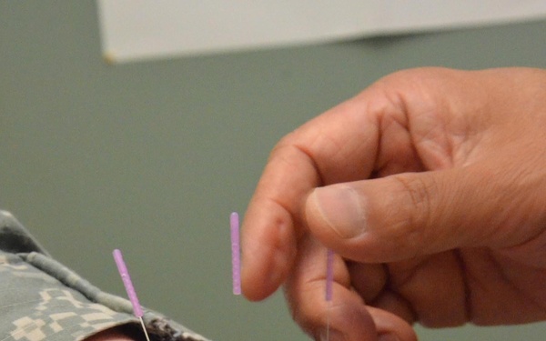 Waiting on pins and needles