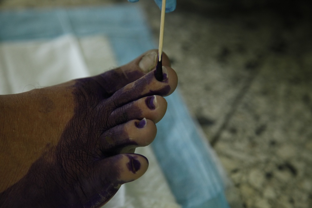 Fixing fungus in Dominican Republic