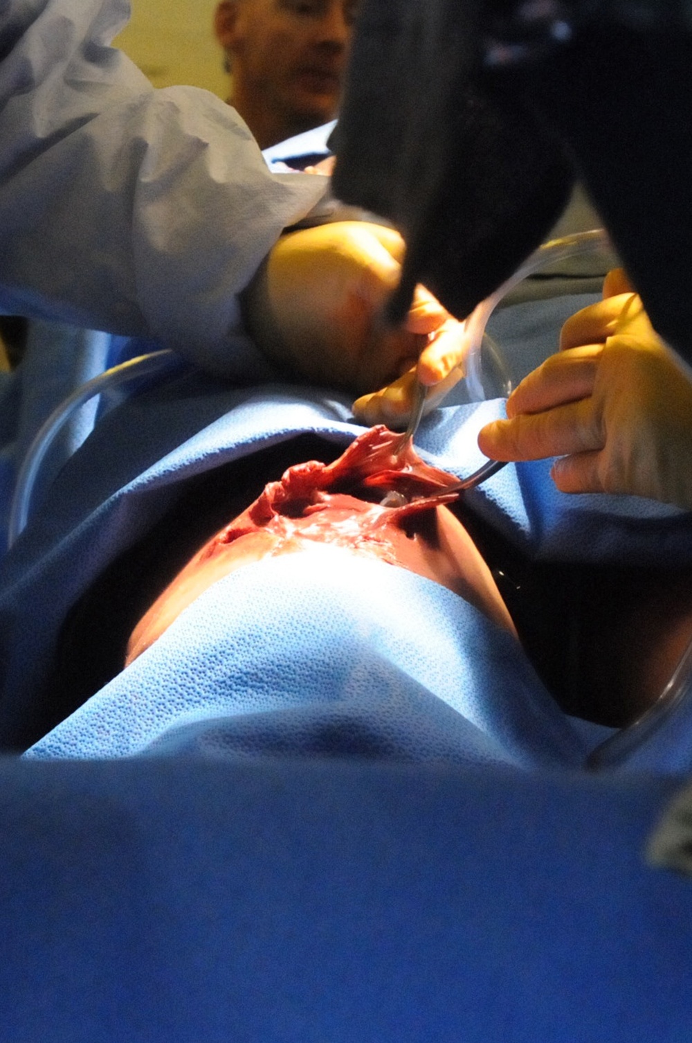 A cut above - Army Reserve surgical training