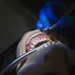 Field dental exercise: 3rd Dental Battalion prepares for oral emergencies