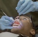 US Marines receive dental treatment during Deployment For Training exercise