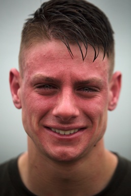 The pain is brutal for these Marines