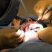Oral surgery
