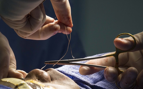 Bougainville boy receives corrective surgery aboard USNS Mercy