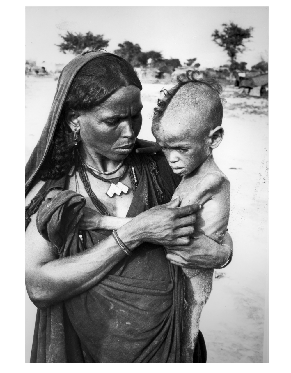 Malnourished child with woman, Niger
