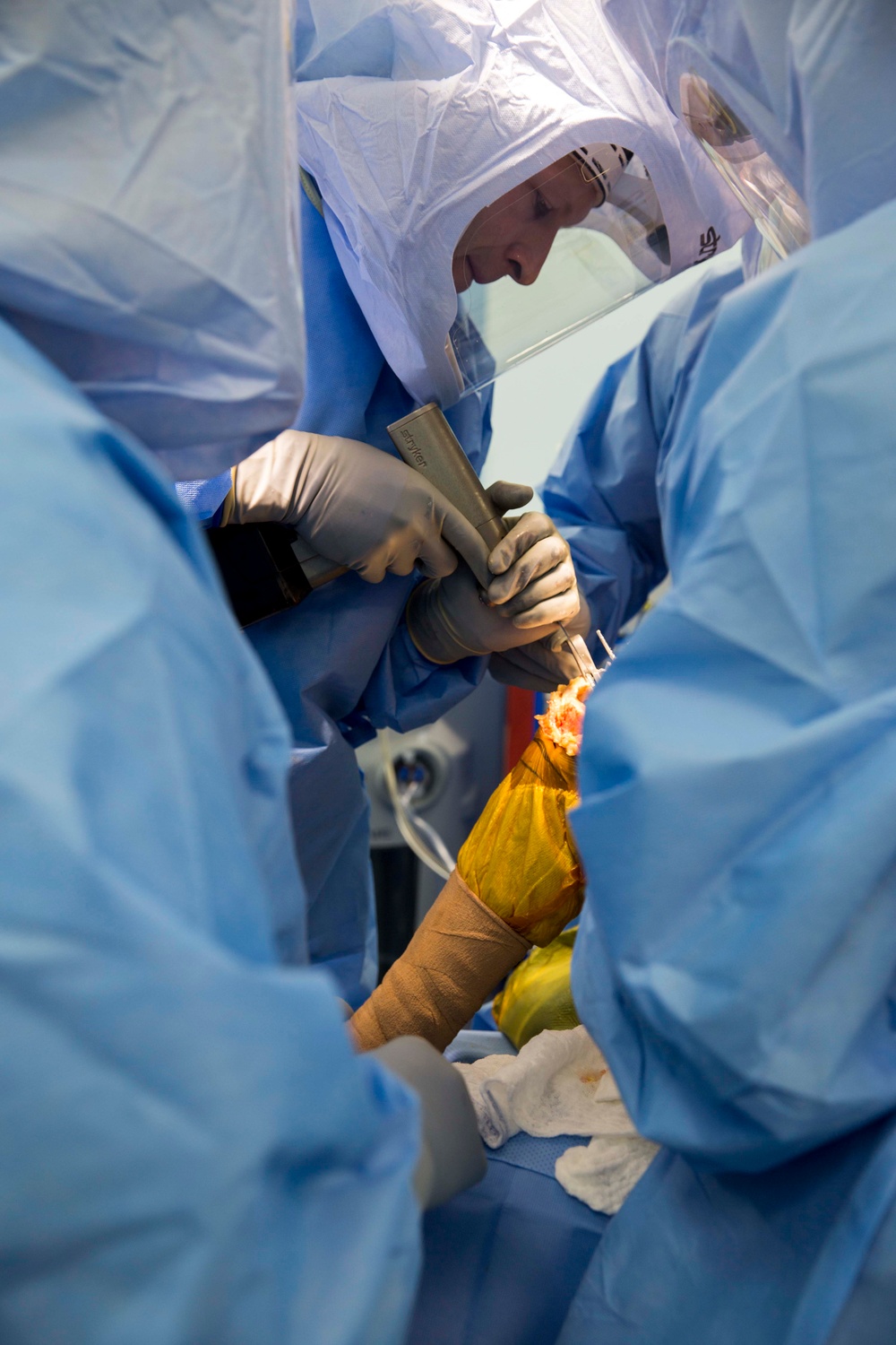 USNS Mercy personnel perform knee replacement surgery for Vietnamese patient