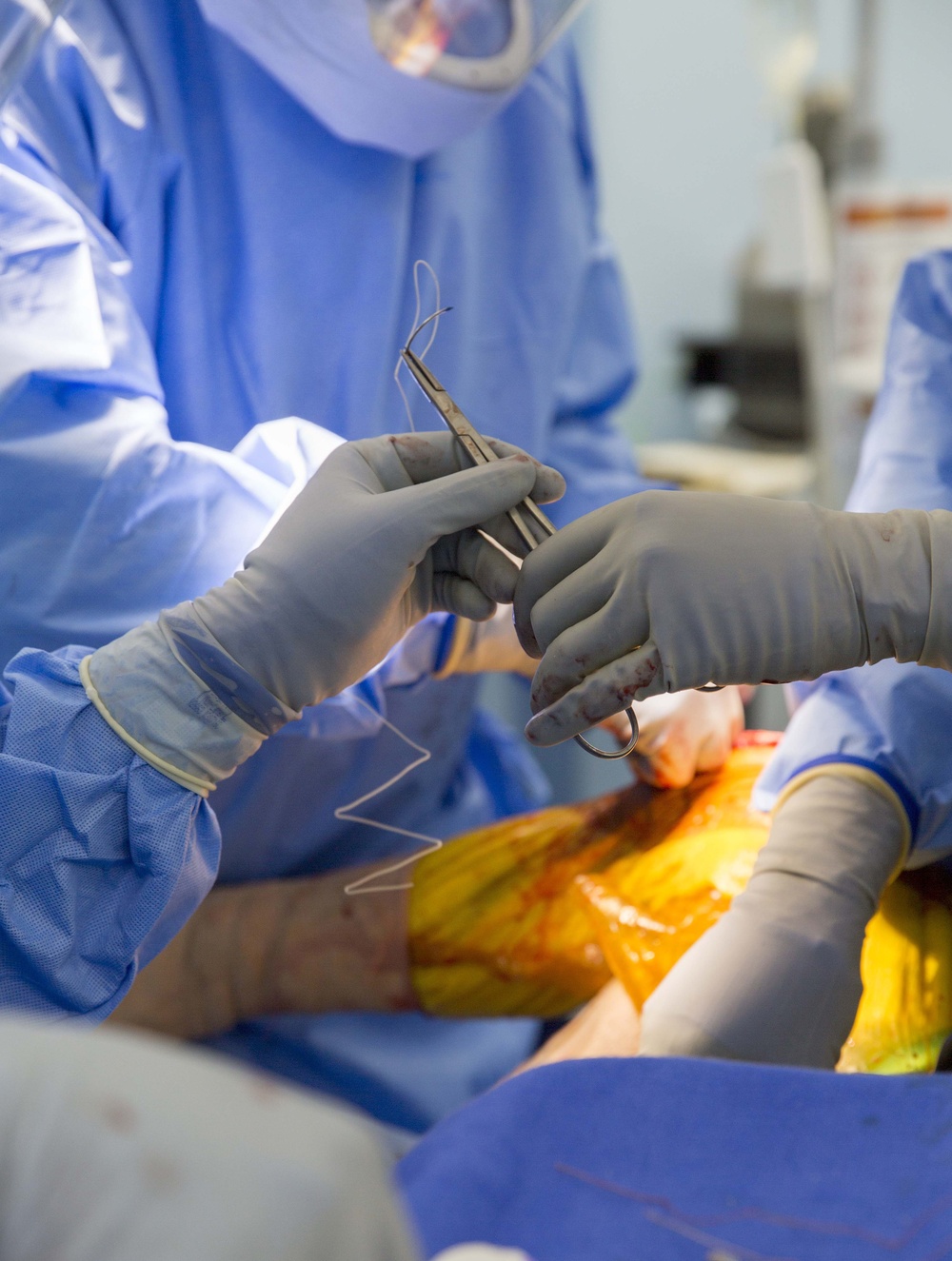 USNS Mercy personnel perform knee replacement surgery for Vietnamese patient