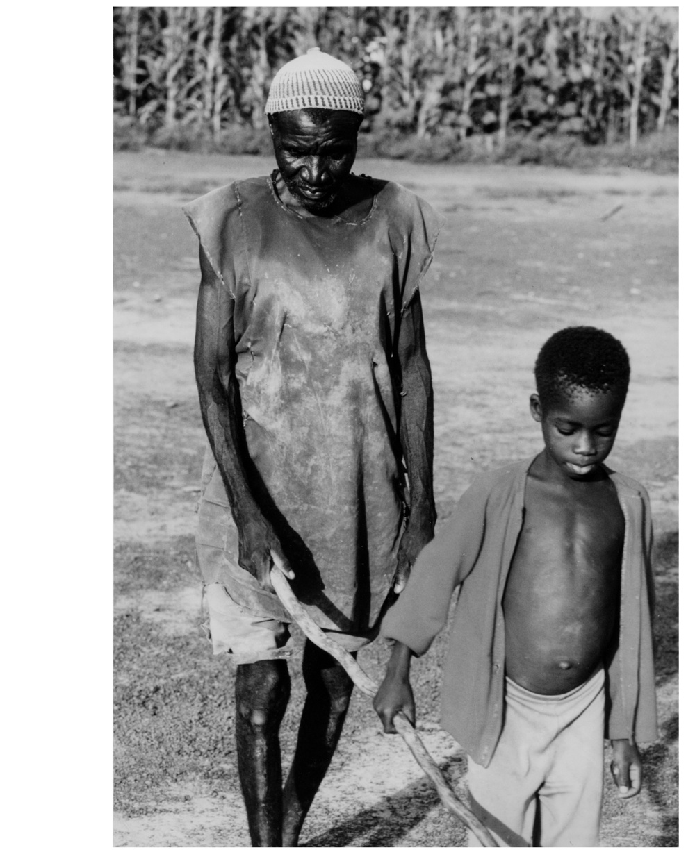 Man Blinded by Onchocerciasis Led by Boy