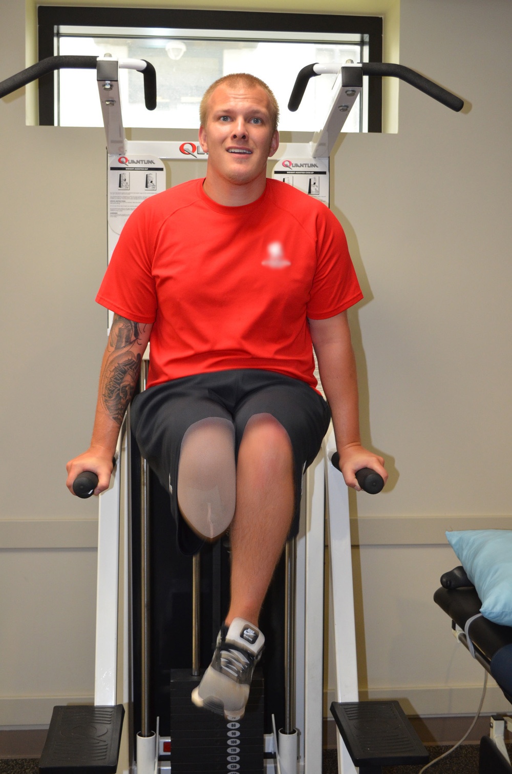 Physical therapists assist amputees with getting their lives back