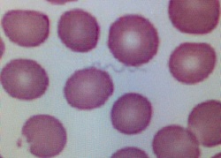 Medical Group first to find bacteria unseen in humans [Image 2 of 2]