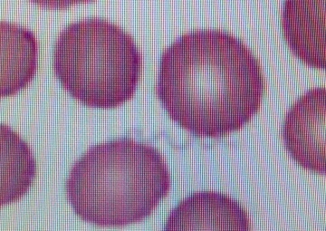 Medical Group first to find bacteria unseen in humans