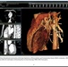 NMLC supports MTF Cardiovascular Image Management Systems