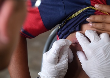 MEDRETE serves more than 8,500 La Blanca residents