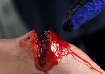 Moulage adds realism to training