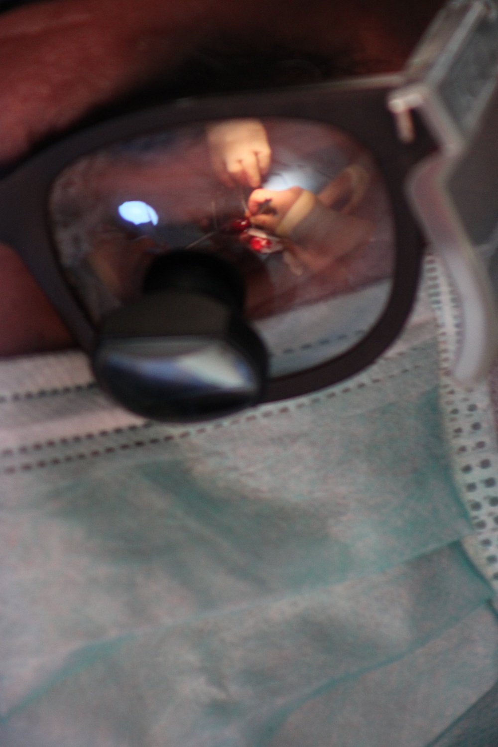 Surgery reflects off the glasses of Army Reserve surgeon as he performs in Chad hospital