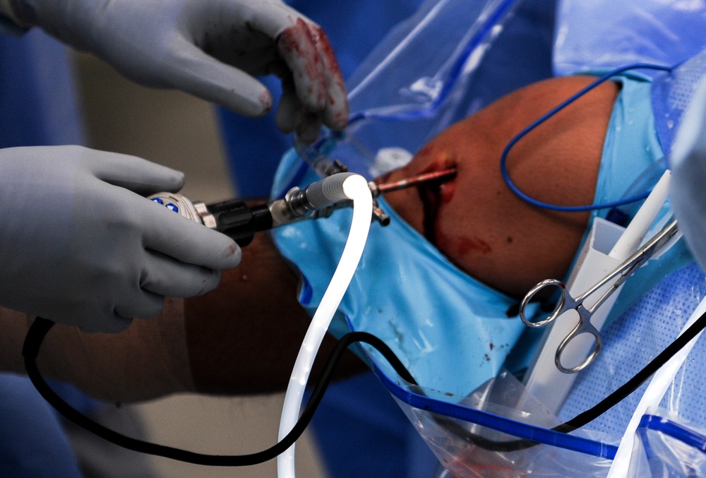 Orthopedic Surgery: getting Airmen back on their feet