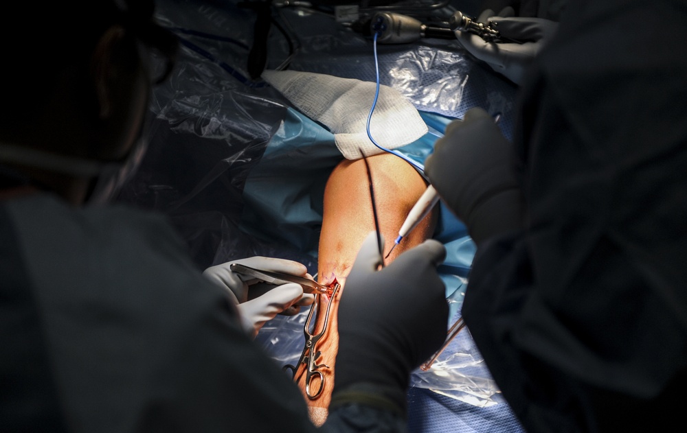 Orthopedic Surgery: getting Airmen back on their feet