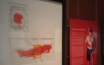 Wounded Warrior &quot;Scar Art&quot; Featured at Medical Museum