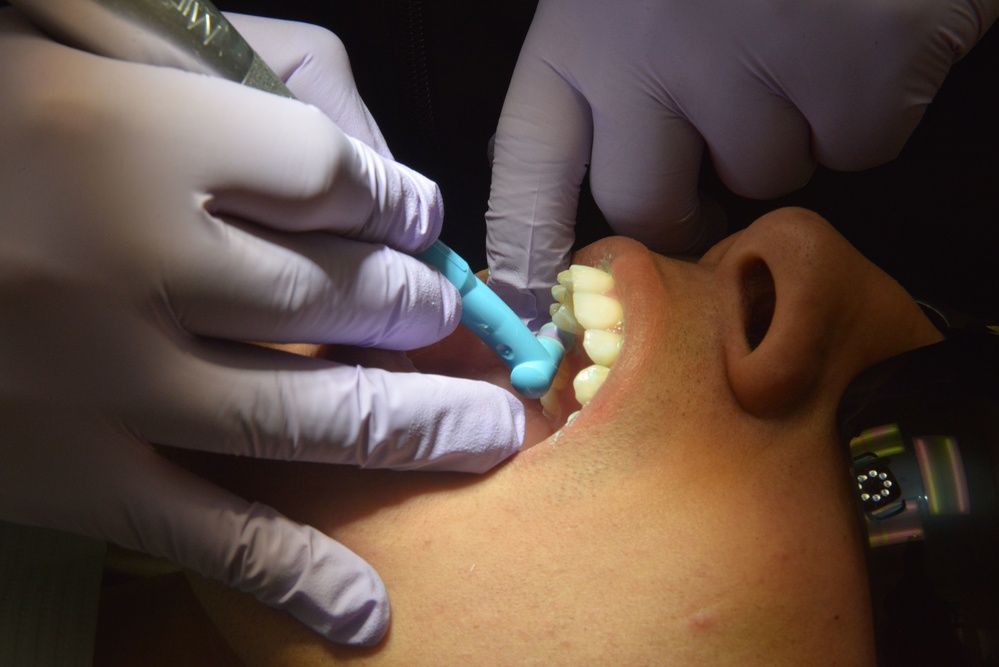 5 MDG: Dental