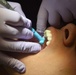 5 MDG: Dental