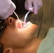 5 MDG: Dental