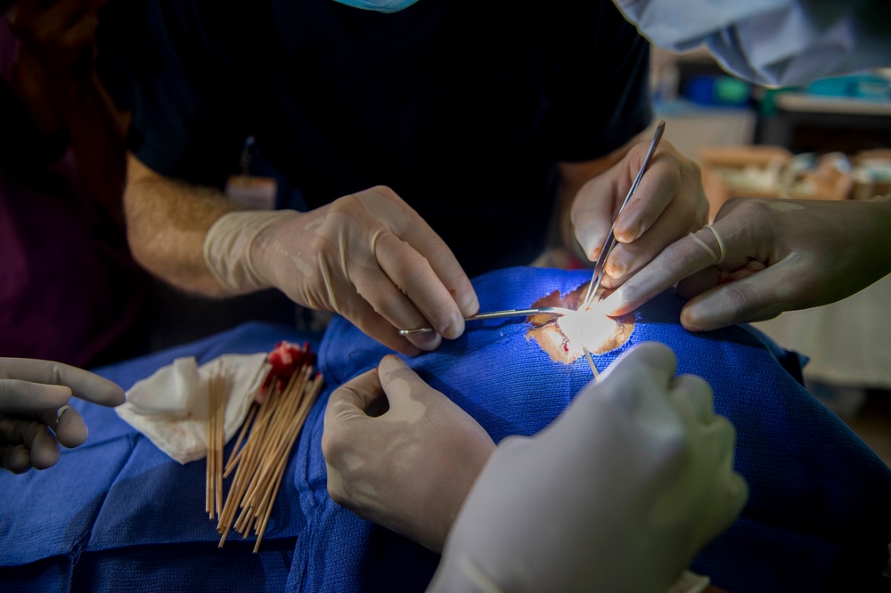 Cmdr. Christopher Crecelius Performs Surgery On The Eyelid of A Host Nation Patient at Continuing Promise 2017