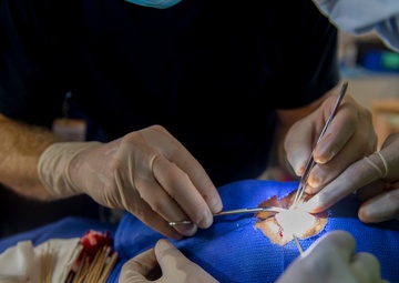 Cmdr. Christopher Crecelius Performs Surgery On The Eyelid of A Host Nation Patient at Continuing Promise 2017
